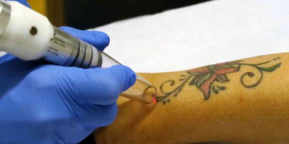 La mania dei tatuaggi è... irreversibile