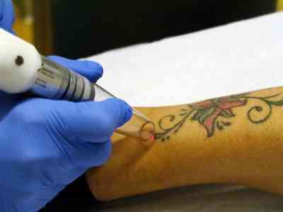 La mania dei tatuaggi è... irreversibile