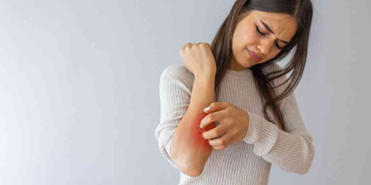 Maledetta psoriasi disturba più la mente che la pelle